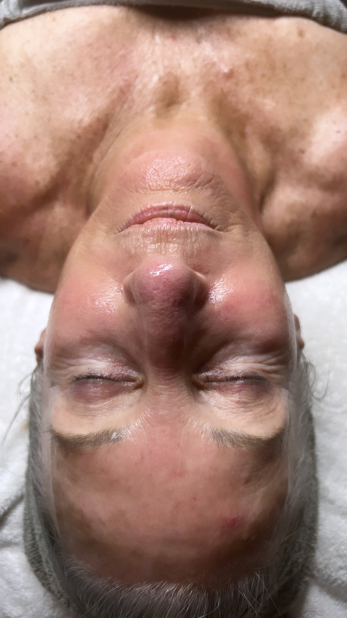 After treatment image